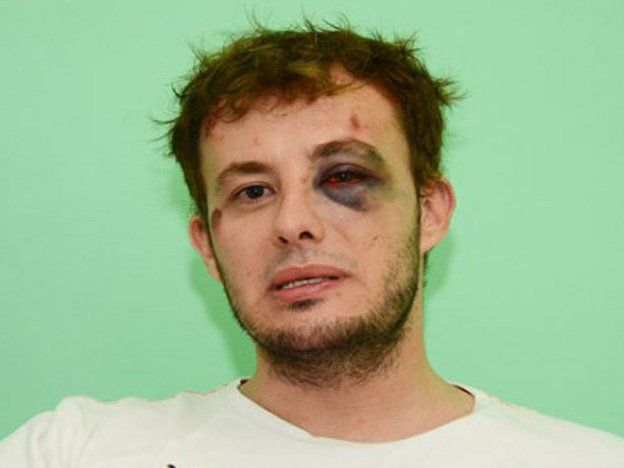 Un joven recibió una brutal golpiza de parte de policías por ser gay