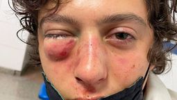 Oscar Colombres sufrió serias lesiones en su rostro.