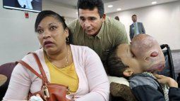 Le extirparán un tumor del rostro de 4 Le extirparán un tumor del rostro de 4