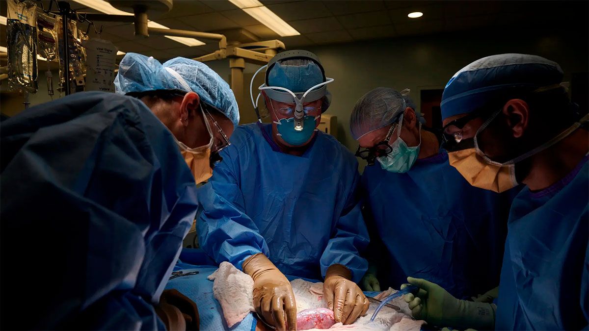 Cirujanos del instituto de trasplante Langone Health
