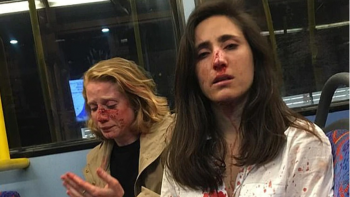 Las obligaron a besarse y, ante la negativa, las golpearon en pleno colectivo
