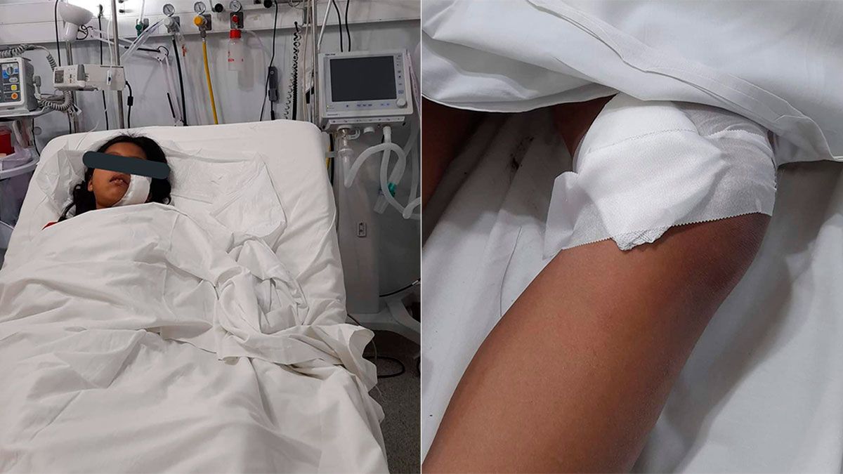 Una joven de 13 años recibió cinco apuñaladas para robarle el celular.