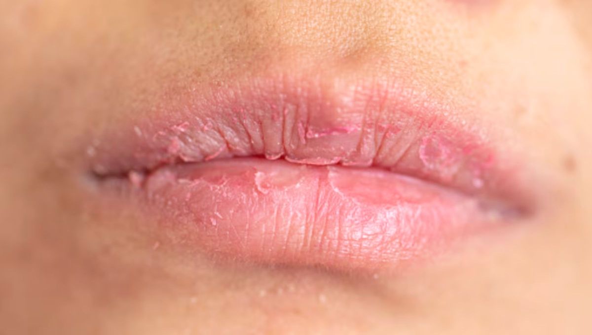 Una de las costumbres o acciones más comunes en las personas es arrancarse los cueros o pellejos de los labios.