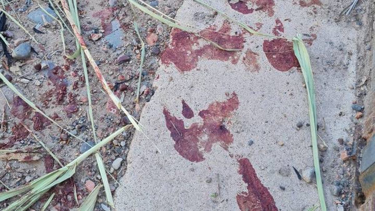 Rastros de las heridas que sufrió Franco C. mientras manipulaba cables de media tensión. Gentileza.