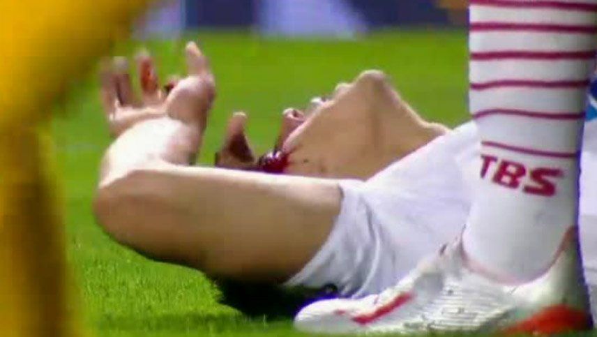 ¡Con la sangre en el ojo! Salcedo chocó con Alonso y preocupó a todos en La Boca