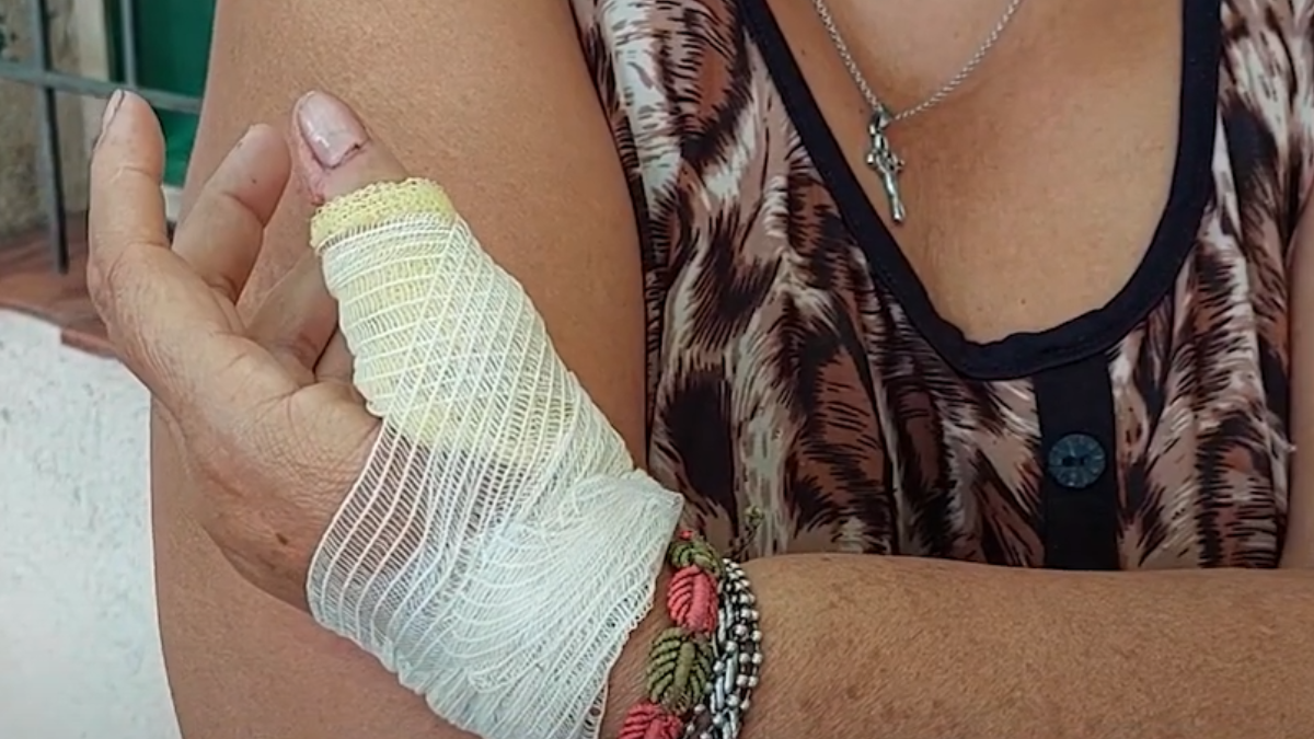 Una mujer y sus hijos fueron atacados violentamente con un cuchillo por una menor de 15 años.