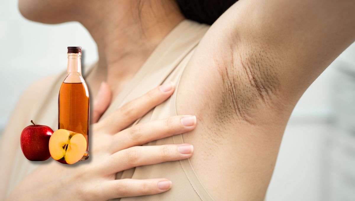 Por qué hay que colocarse vinagre de manzana en las axilas: ¿qué significa?