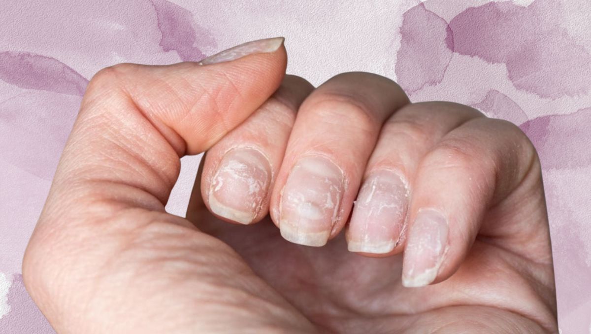 Qué significa tener las uñas quebradizas