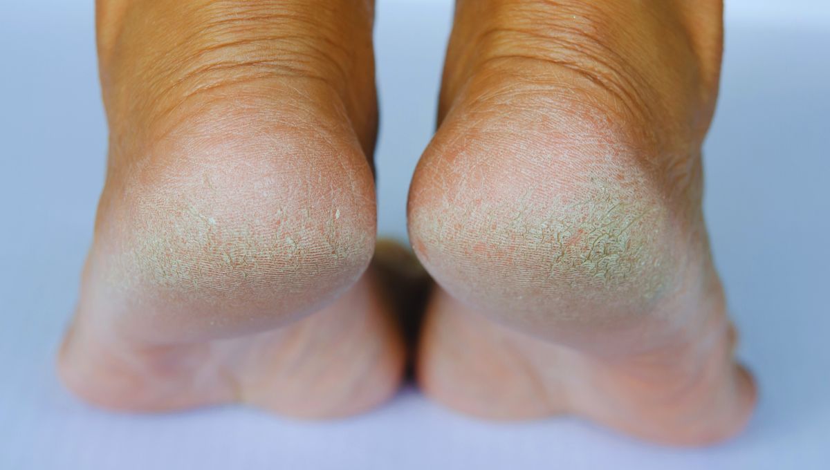 Mi truco estético con bicarbonato para eliminar las durezas de los pies