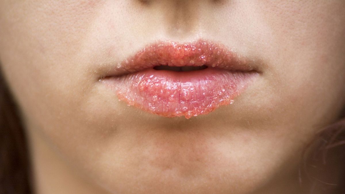 Cómo crear un exfoliante para la labios. Cómo crear un exfoliante para la labios.