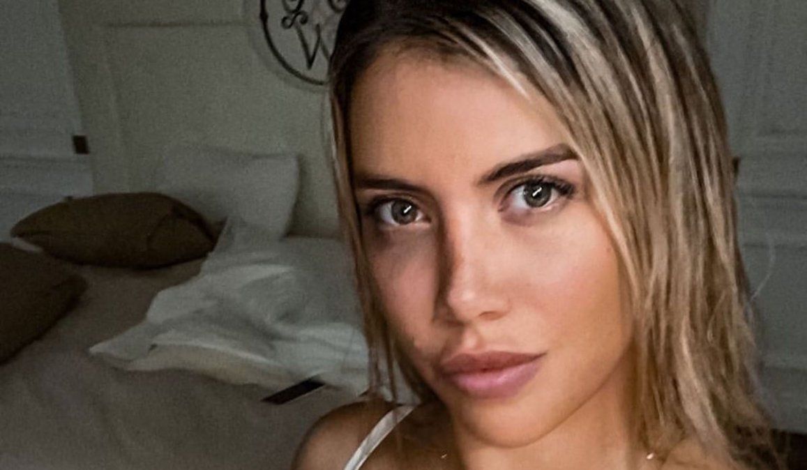 Wanda Nara, ¡qué se hizo en la cara!