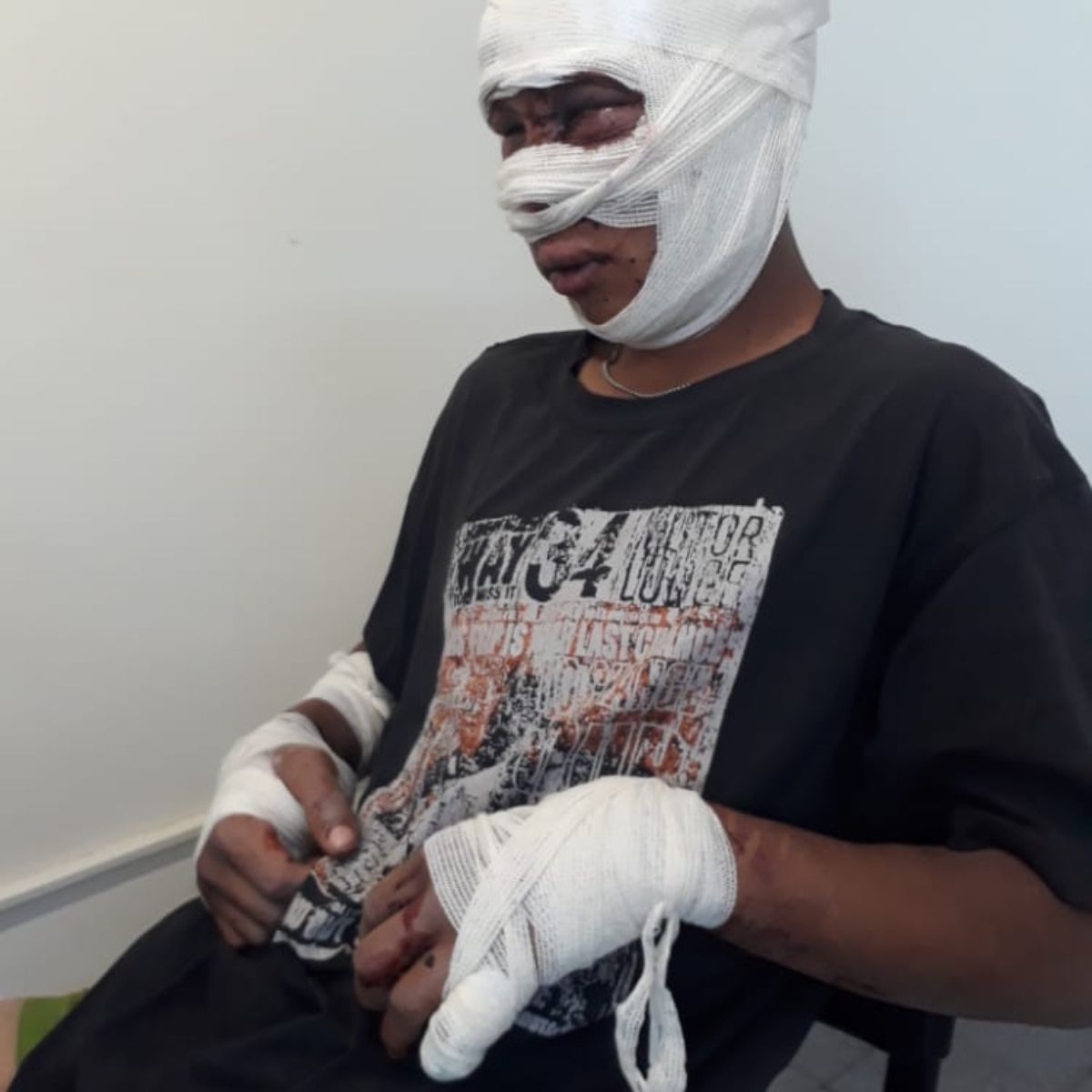 En este estado fue trasladado Agustín, del hospital a la comisaría de El Algarrobal, para prestar declaración. Sus agresores no quedaron detenidos.