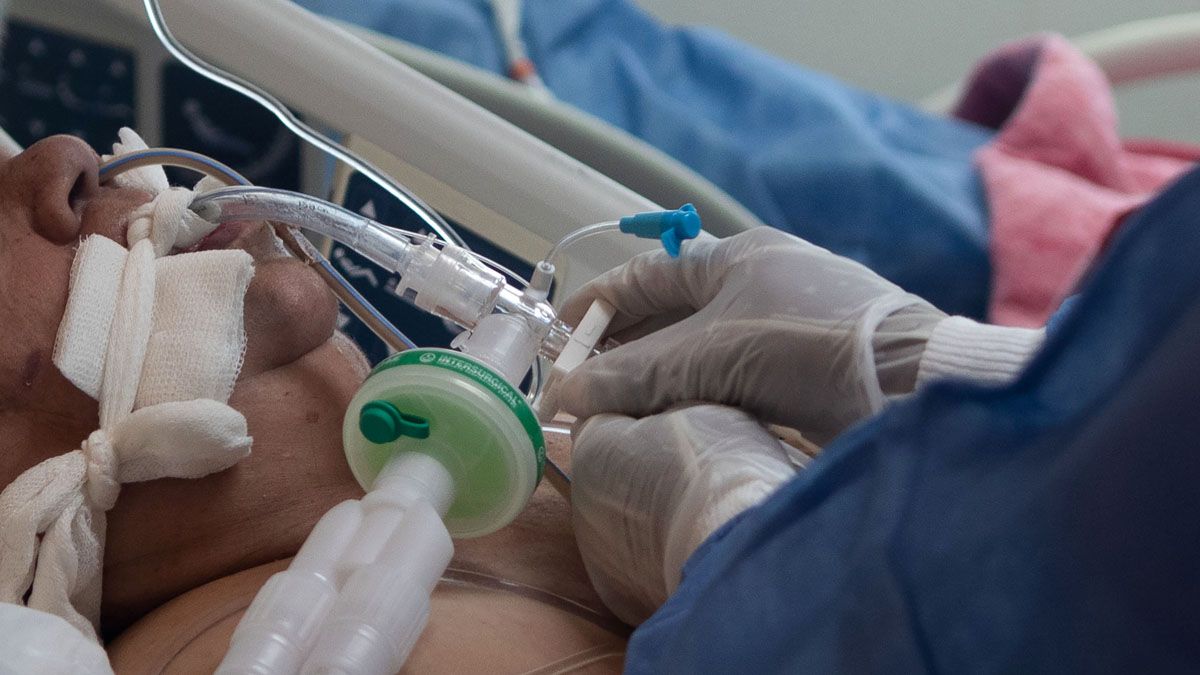 Este viernes se reportaron 557 muertos por Covid en el país, entre ellos 309 hombres y 243 mujeres.