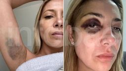 Las fotos que aparecieron de Fabiola Yañez golpeada.