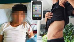 Cambió su riñón por un iPhone y fue totalmente errático. Cambió su riñón por un iPhone y fue totalmente errático.