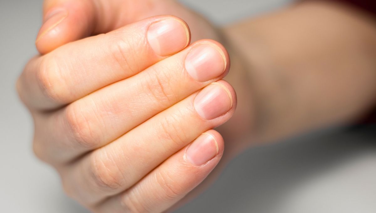 Además, el vinagre ayuda a restaurar el equilibrio ácido natural de la piel que rodea las uñas. Además, el vinagre ayuda a restaurar el equilibrio ácido natural de la piel que rodea las uñas.