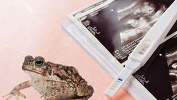 El invento argentino que se usó en toda América Latina para detectar embarazos con sapos El invento argentino que se usó en toda América Latina para detectar embarazos con sapos