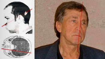 Un rayo de protones atravesó su cara en un accidente científico pero logró sobrevivir Un rayo de protones atravesó su cara en un accidente científico pero logró sobrevivir