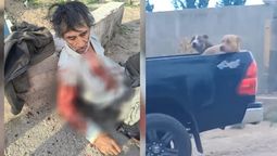 Video: así se llevaron a los perros que atacaron brutalmente a un hombre en Las Heras Video: así se llevaron a los perros que atacaron brutalmente a un hombre en Las Heras