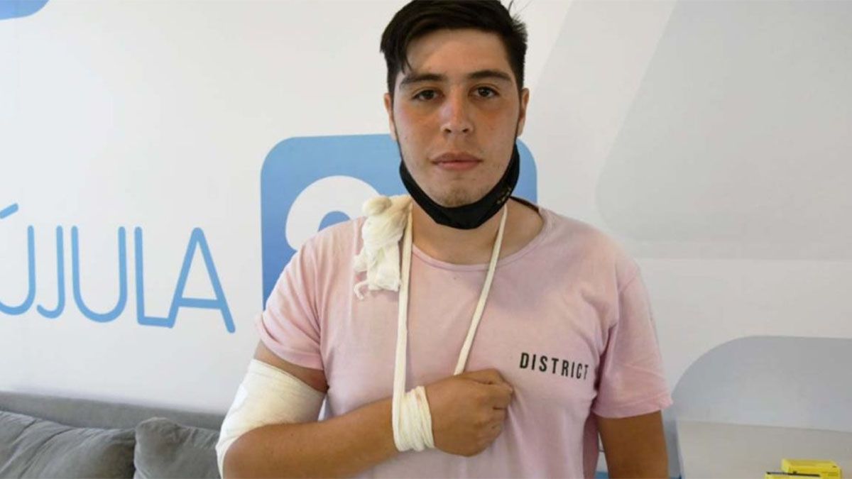 El árbitro sufrió quemaduras en el brazo.