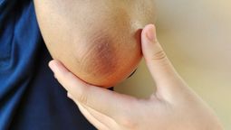 ¿Cómo hacer una mascarilla de cúrcuma para aclarar la piel de los codos y rodillas?