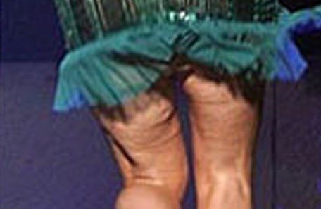 ¿De quién es esta celulitis?
