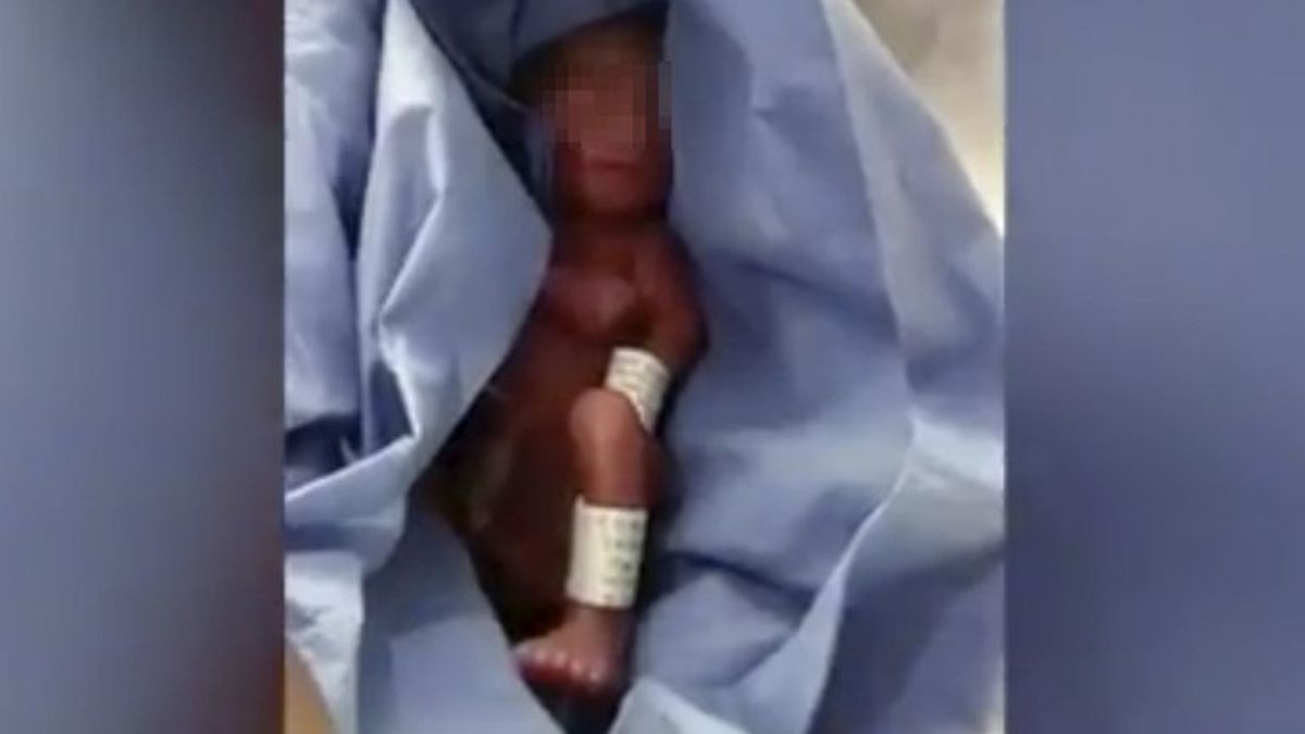 Un bebé fue dado por muerto y a las horas comenzó a llorar.