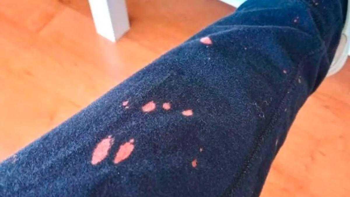 Dile adiós a las manchas de lavandina de tu ropa con el truco de limpieza que más te convenga Dile adiós a las manchas de lavandina de tu ropa con el truco de limpieza que más te convenga