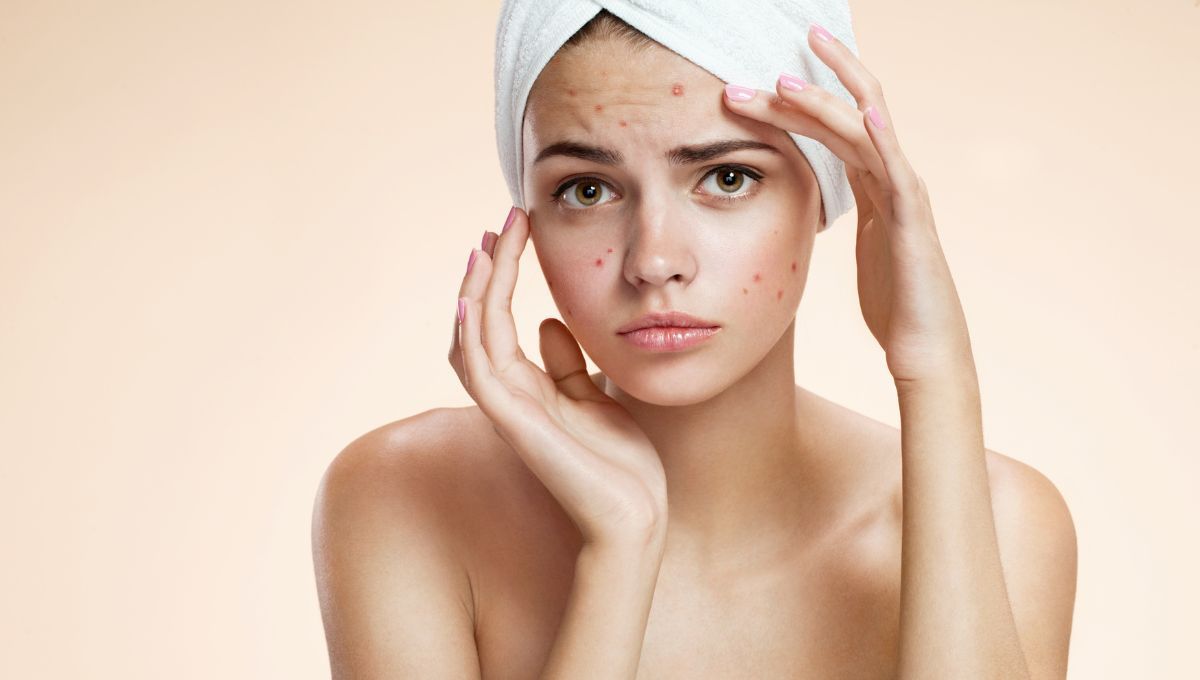 Granitos en la frente. Granitos en la frente.