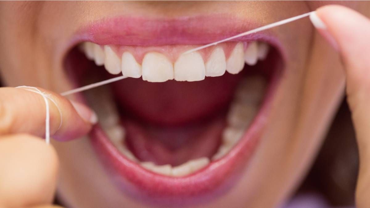 Cómo eliminar el sarro de los dientes.