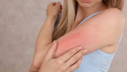 Usar ropa sintética puede llevarnos a tener reacciones en nuestra piel, sobre todo si la tenemos sensible. Imagen: Blog Oncosalud Usar ropa sintética puede llevarnos a tener reacciones en nuestra piel, sobre todo si la tenemos sensible. Imagen: Blog Oncosalud