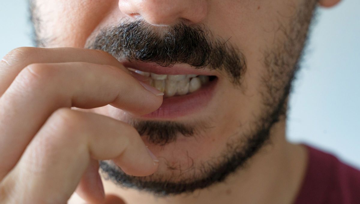 Desde el punto de vista médico, la onicofagia (del griego onyx, ‘uña’, y phagein, ‘comer’), nombre que se le da a esta mala conducta, es un síndrome psicológico relacionado con un trastorno obsesivo-compulsivo. Desde el punto de vista médico, la onicofagia (del griego onyx, ‘uña’, y phagein, ‘comer’), nombre que se le da a esta mala conducta, es un síndrome psicológico relacionado con un trastorno obsesivo-compulsivo.