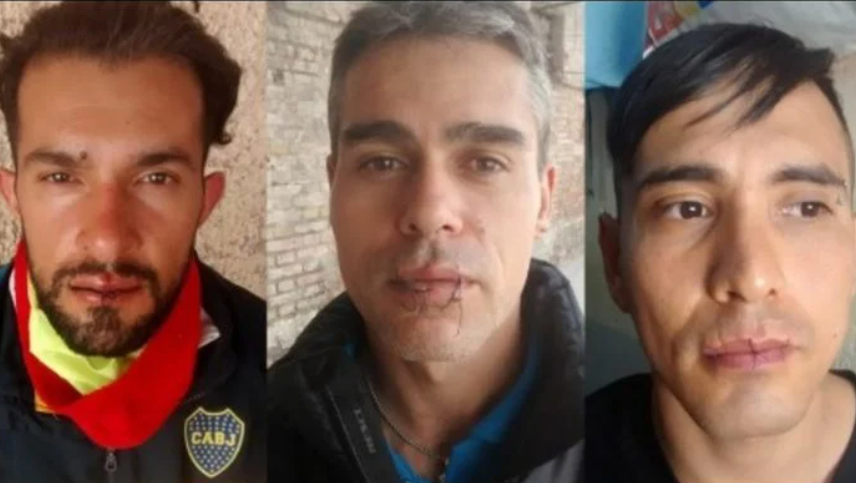 Internos de Boulogne Sur Mer y San Felipe se cosieron la boca como forma de protesta