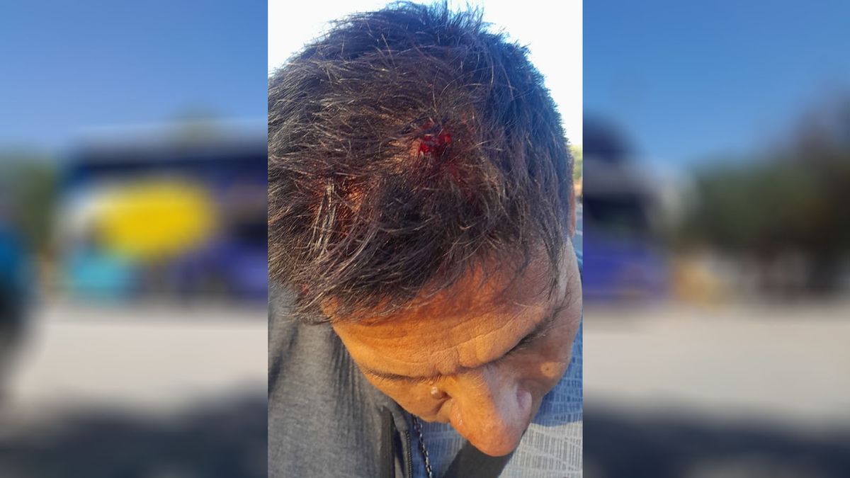 Uno de los mendocinos que viajaba en el tour de compras fue golpeado por los delincuentes y le provocaron un corte en el cuero cabelludo. Uno de los mendocinos que viajaba en el tour de compras fue golpeado por los delincuentes y le provocaron un corte en el cuero cabelludo.