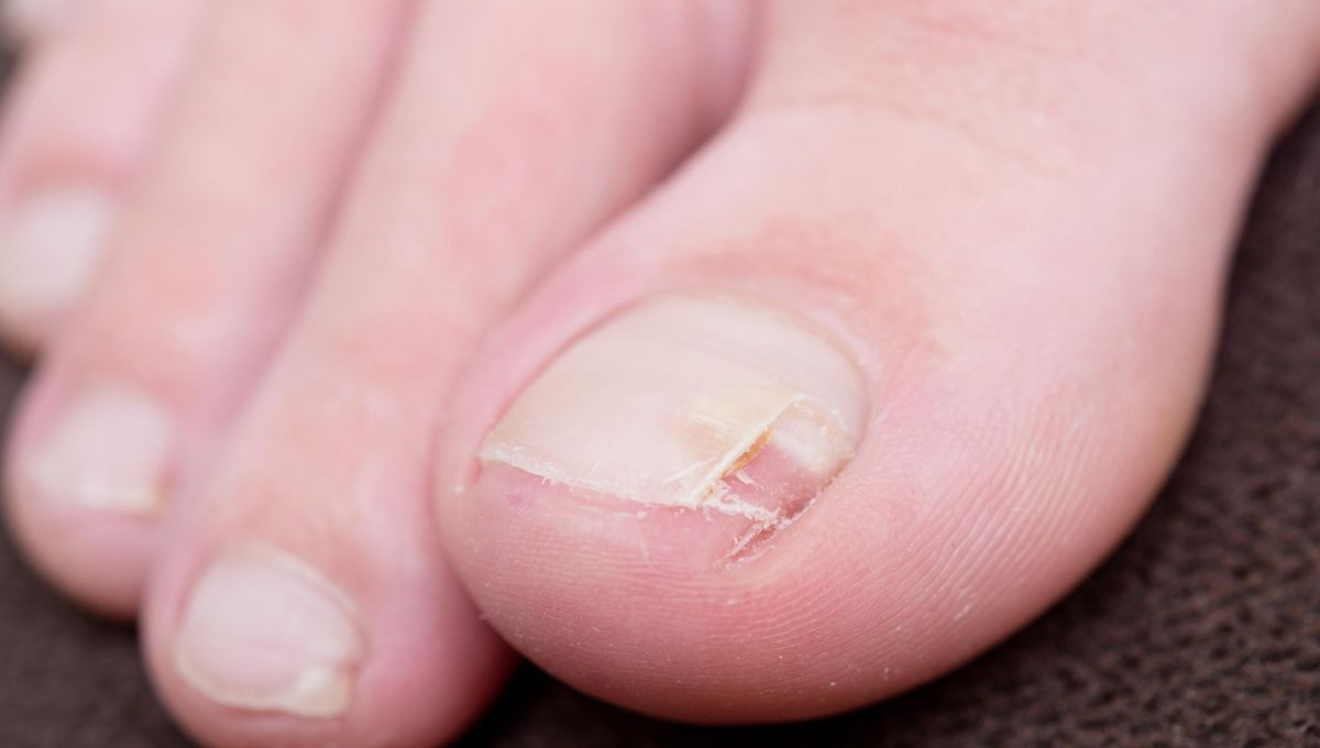 Evita las uñas encarnadas en los pies con estos simples consejos de higiene