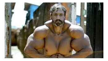 Se inyecta aceite para parecerse a Hulk