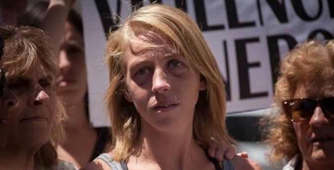 No me sirve que esté arrepentido, lo quiero preso, dijo la joven desfigurada por su ex