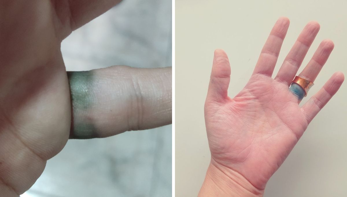 Por qué las joyas o accesorios de plata manchan la piel de color negro o verde