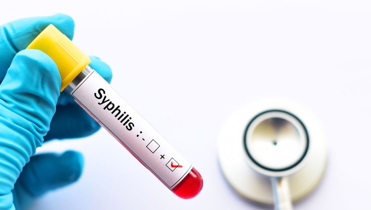 La sífilis no puede ser transmitida a través de objetos