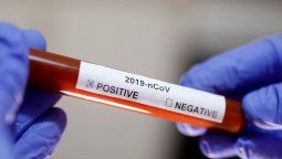 Coronavirus en Argentina: hubo 4 muertos y 134 nuevos casos y el número de contagiados superó los 5.000