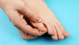 El secreto de las mujeres andinas para eliminar hongos de los pies