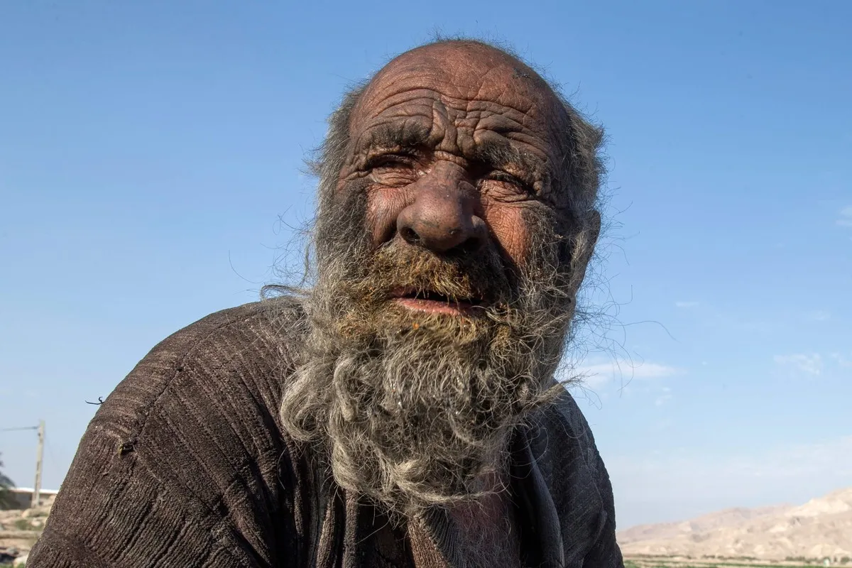 El rey de la mugre. Este iraní pasó más de 60 años sin tocar el agua y el jabón.&nbsp;