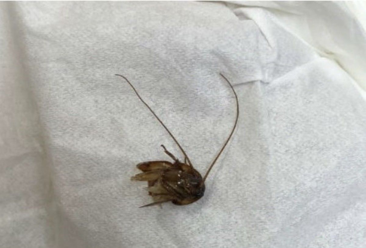 La cucaracha estuvo nueve días dentro de la cabeza de la mujer. La cucaracha estuvo nueve días dentro de la cabeza de la mujer. 