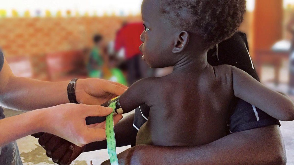 Hambre y enfermedad amenazan a niños en África