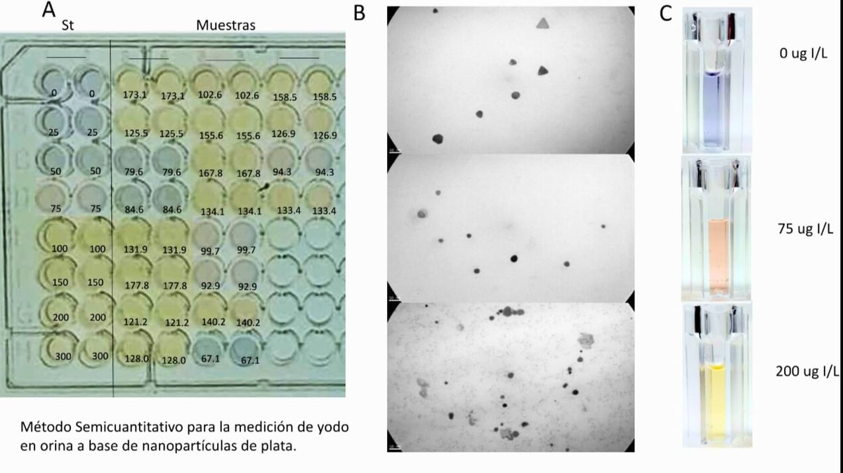 Así se ven las nanopartículas utilizadas en la determinación de iodo en la orina, con los colores que identifican si su nivel es adecuado o no Así se ven las nanopartículas utilizadas en la determinación de iodo en la orina, con los colores que identifican si su nivel es adecuado o no
