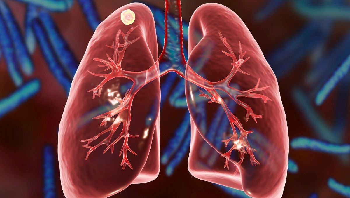 Hoy es el Día de los pulmones. Hoy es el Día de los pulmones.
