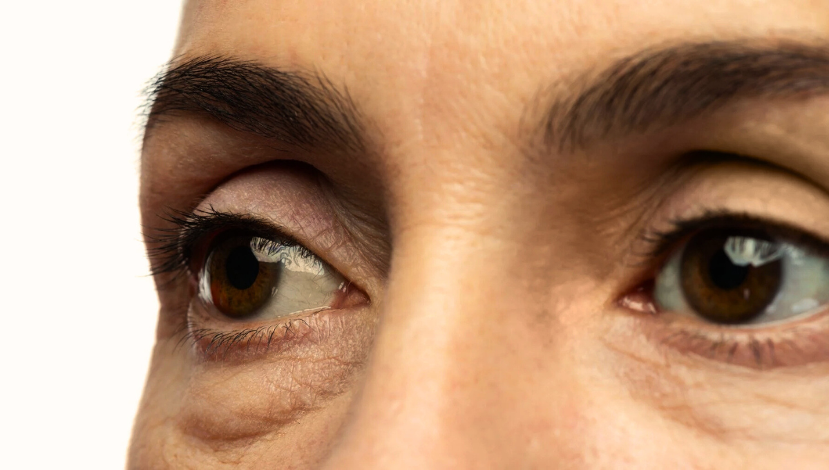 Como usar la vaselina para eliminar ojeras