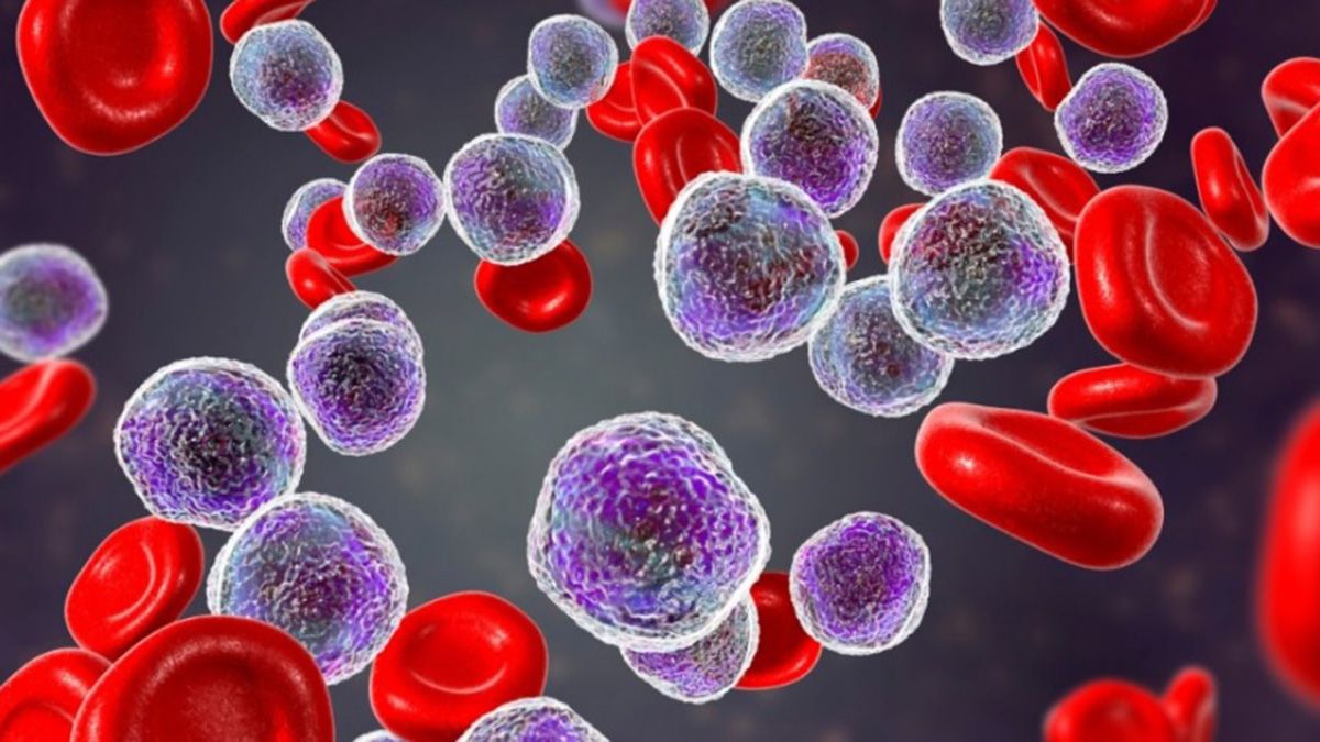 Estudios y tratamientos. Leucemia: ¿Cuáles son los síntomas más identificables?