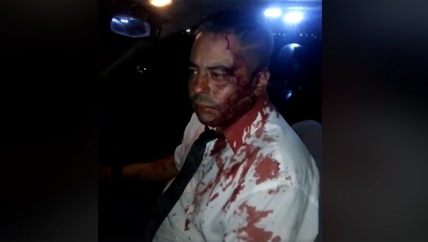 Asaltaron y golpearon con brutalidad a un taxista