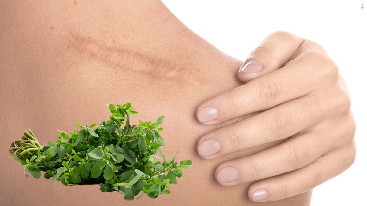 La planta que crece en el jardín, se puede comer en ensaladas, calma las heridas y reduce cicatrices